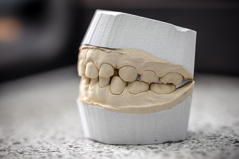 dental-casting-gypsum-model-plaster-P7YSVZB