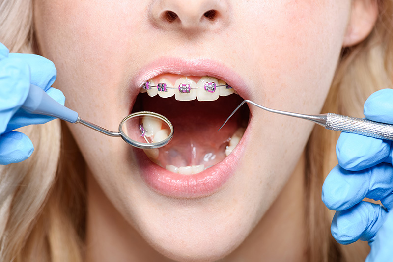 orthodontics-image1