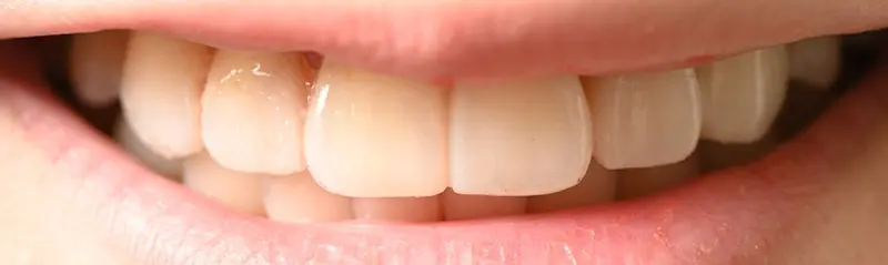 盧盈汝3 2