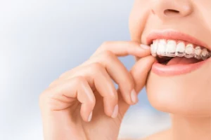 隱適美配戴習慣決定矯正成果？新月牙醫專業提醒你
